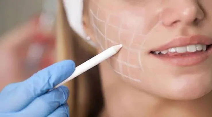 Skinbooster
