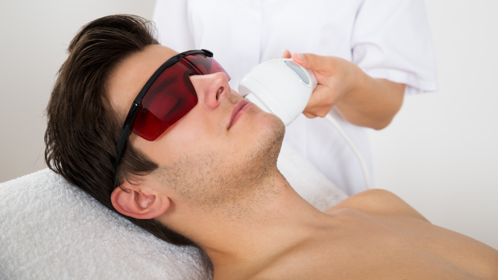 Depilação a Laser para Homens: Benefícios e Cuidado
